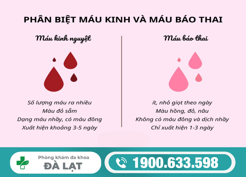Hình ảnh minh họa